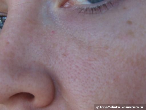 Средство для глубокого очищения кожи лица физиогель отзывы