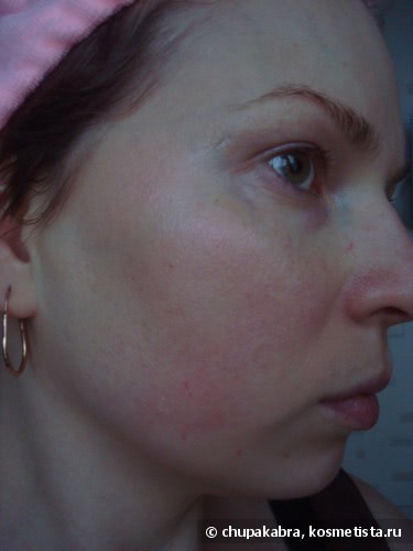 Кремы для кожи лица с куперозом отзывы