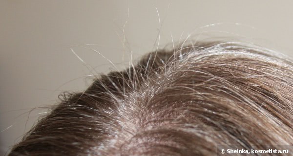 Система 4 лосьон от выпадения волос отзывы
