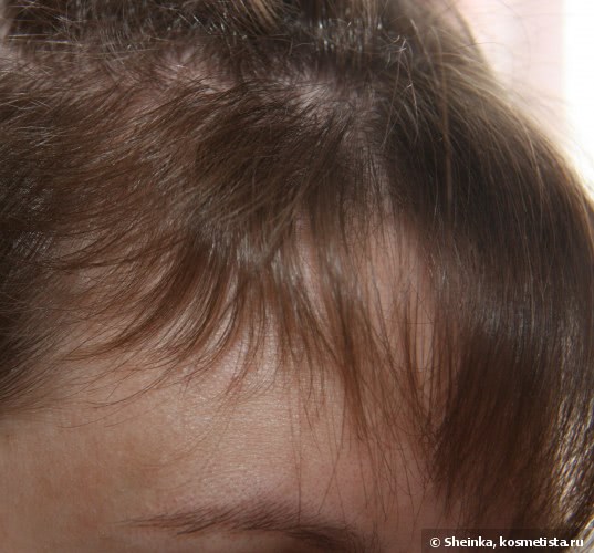 Система 4 для волос сыворотка от выпадения волос
