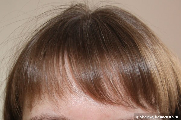 Комплекс от выпадения волос систем 4 отзывы