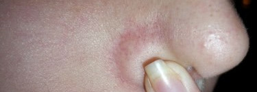 Борьба с черными точками с Clean & Clear ежедневный скраб от черных точек