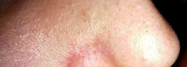 Борьба с черными точками с Clean & Clear ежедневный скраб от черных точек