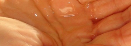 Matrix начинает и выигрывает