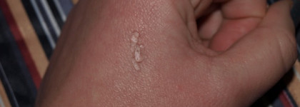 Мои помощники по уходу за кожей вокруг глаз. Кремы