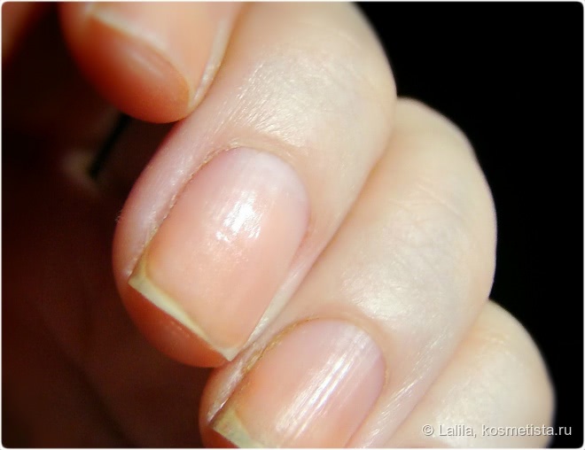 Eveline Cosmetics Nail Therapy - экспресс-удалитель кутикулы