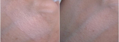 Сравнение консилеров L'Oreal Lumi magique, Yves Saint Laurent Touche Eclat и Dior Skinflash