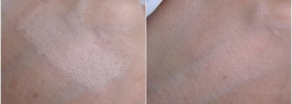 Сравнение консилеров L'Oreal Lumi magique, Yves Saint Laurent Touche Eclat и Dior Skinflash