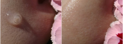 The Ordinary Niacinamide 10% +Zinc 1%. Сыворотка с ниацинамидом и цинком