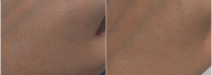 SVR Sebiaclear Active. Активный крем-уход за проблемной кожей