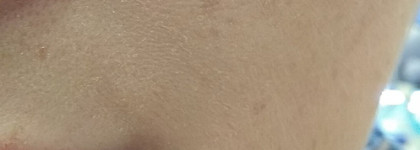 Ежедневный уход