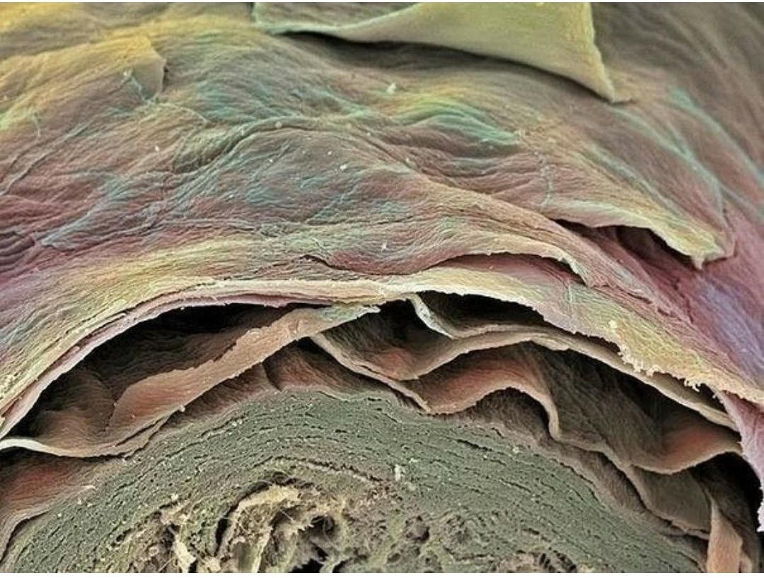 На фото - срез кожи человека под микроскопом. Нижняя часть - ее живой эпидермис, а верхний - отшелушившийся ороговевший слой. От то и защищает организм от внешних воздействий.
