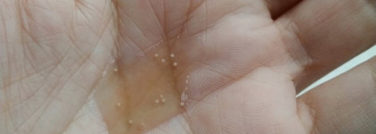 Blithe Vital Treatment 8 Nourishing Beans - эссенция для плотности и упругости кожи