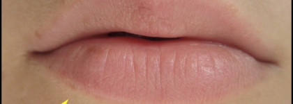 Dr. Pierre Ricaud - Les perfecteurs crayon cupidon