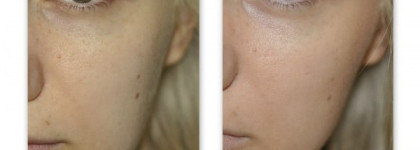 Clarins BB Skin Perfecting Cream Broad Spectrum Sunscreen SPF 25 ― 02 medium
