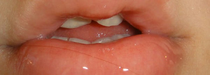 Lip gloss Beauty Rush Victoria's Secret-Candy baby