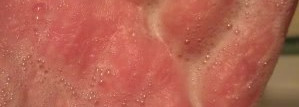 Уход за проблемной кожей в двух частях (часть I - La Roche-Posay)