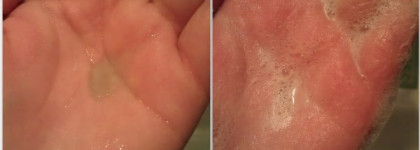 Уход за проблемной кожей в двух частях (часть II - Ducray, Uriage и еще некоторые)