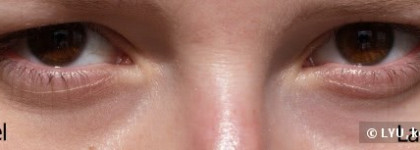 О корректорах Chanel Eclat Lumiere № 20 и Lancome Teint Miracle Instant Retouch Pen №1