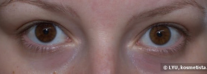 О корректорах Chanel Eclat Lumiere № 20 и Lancome Teint Miracle Instant Retouch Pen №1