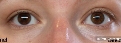 О корректорах Chanel Eclat Lumiere № 20 и Lancome Teint Miracle Instant Retouch Pen №1