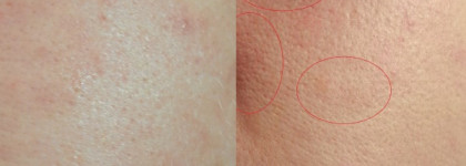 Жидкие тональные основы. Часть первая: тональный крем и кремы с тональным эффектом (Shiseido, Clarins, Anna Lotan)