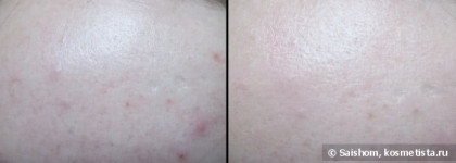 Моя косметичка и повседневный макияж, сделанный с помощью ее содержимого