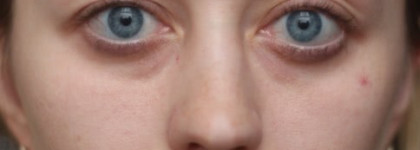 Уход за лицом после зимы с Estee Lauder Advanced Night Repair Concentrate