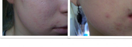 От идела к идеалу