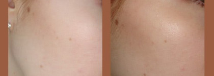 Мое бронзовое лето от Givenchy