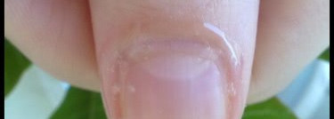 Три собрата в борьбе с кутикулой