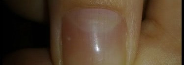 Три собрата в борьбе с кутикулой