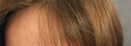 Шампунь и крем препятствующие выпадению и активирующие рост волос от Concept (Green line)