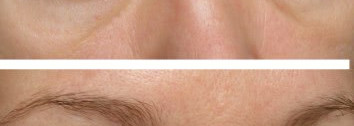 Если очи - не очень. Lumene Time Freeze Instant Lift Eye Serum сыворотка с эффектом моментального лифтинга