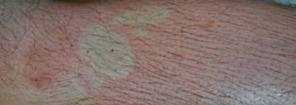 Clinique Face/Body Cream SPF 15