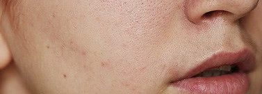 Bourjois - Healthy Mix Foundation #51 light vanilla