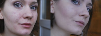 Hanskin Acne Control B.B