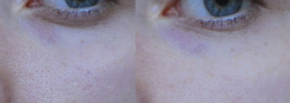 Clinique Pore Minimizer Instant Perfector #01 invisible light/naturel clair