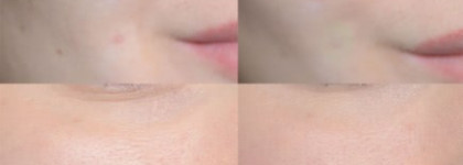Catrice Allround Concealer