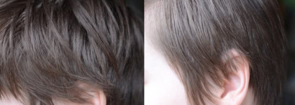 Syoss Anti-grease dry shampoo