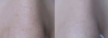 Welcos Color Change Blemish Balm SPF 25/PA++