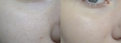 Lumene Color Correcting Cream Meikkivoide With Arctic Lingonberry 6 in 1 #light