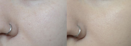 Lumene Color Correcting Cream Meikkivoide With Arctic Lingonberry 6 in 1 #light