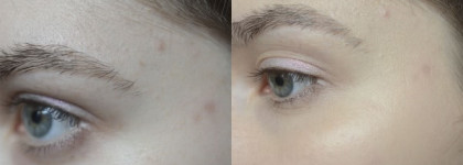 Lumene Color Correcting Cream Meikkivoide With Arctic Lingonberry 6 in 1 #light