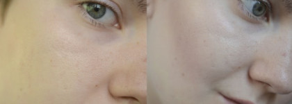 Chanel - Joues Contraste Powder Blush #63 (Plum Attraction)