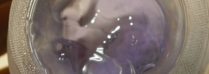 Два борца за красоту глаз