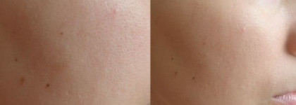 Плохой и хороший тон  с Chanel Perfection Lumiere 32 и  Diorskin  Forever 022