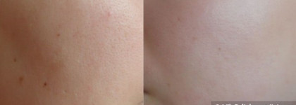 Плохой и хороший тон  с Chanel Perfection Lumiere 32 и  Diorskin  Forever 022