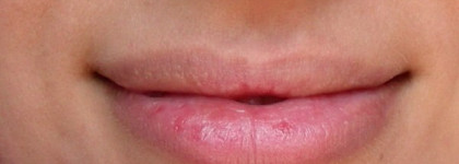 Artdeco Hidra Lip Booster №28. Блеск для губ