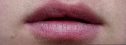 Clinique Chubby Stick Moisturizing Lip Colour Balm # 06 Woppin` watermelon